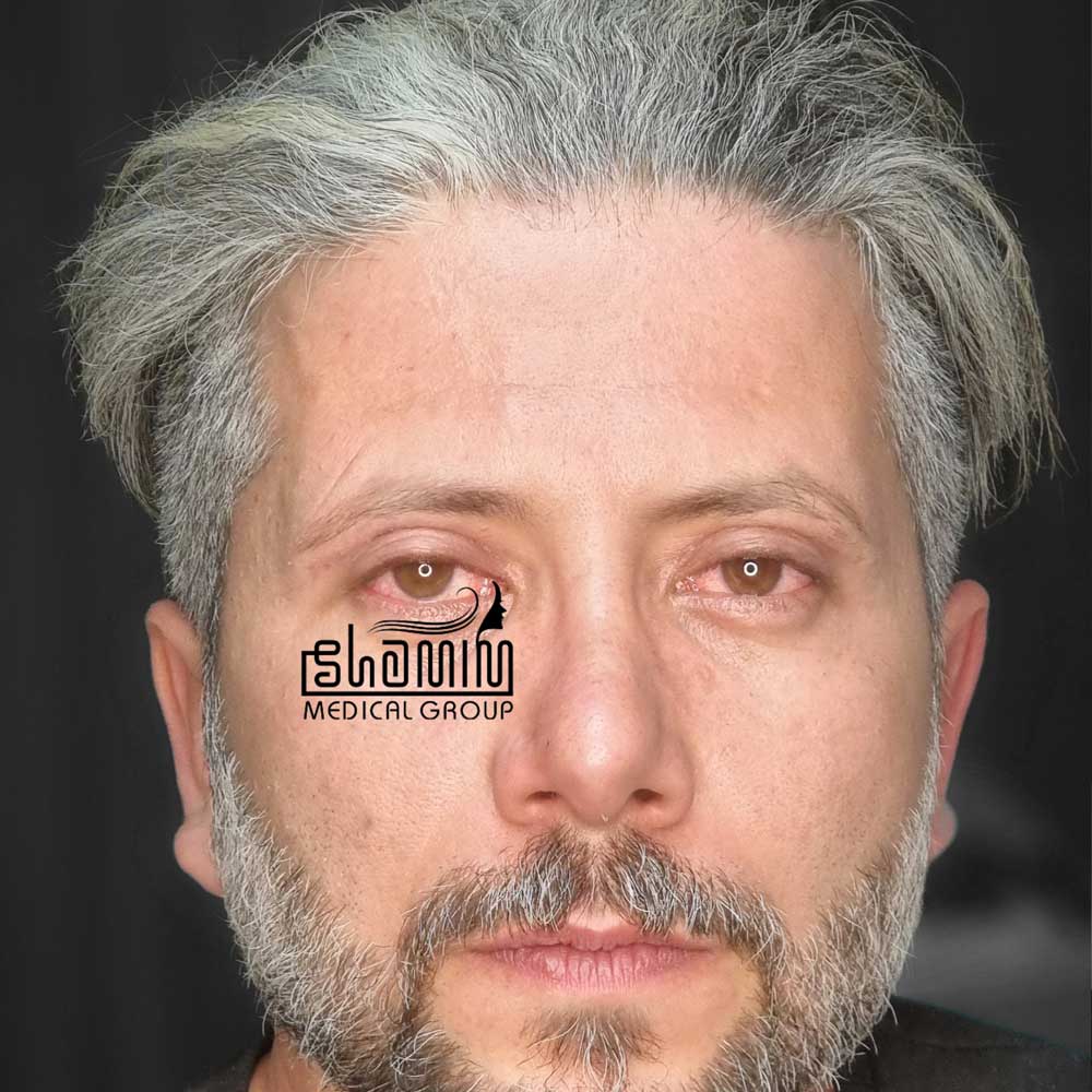بعد - کیس ۲