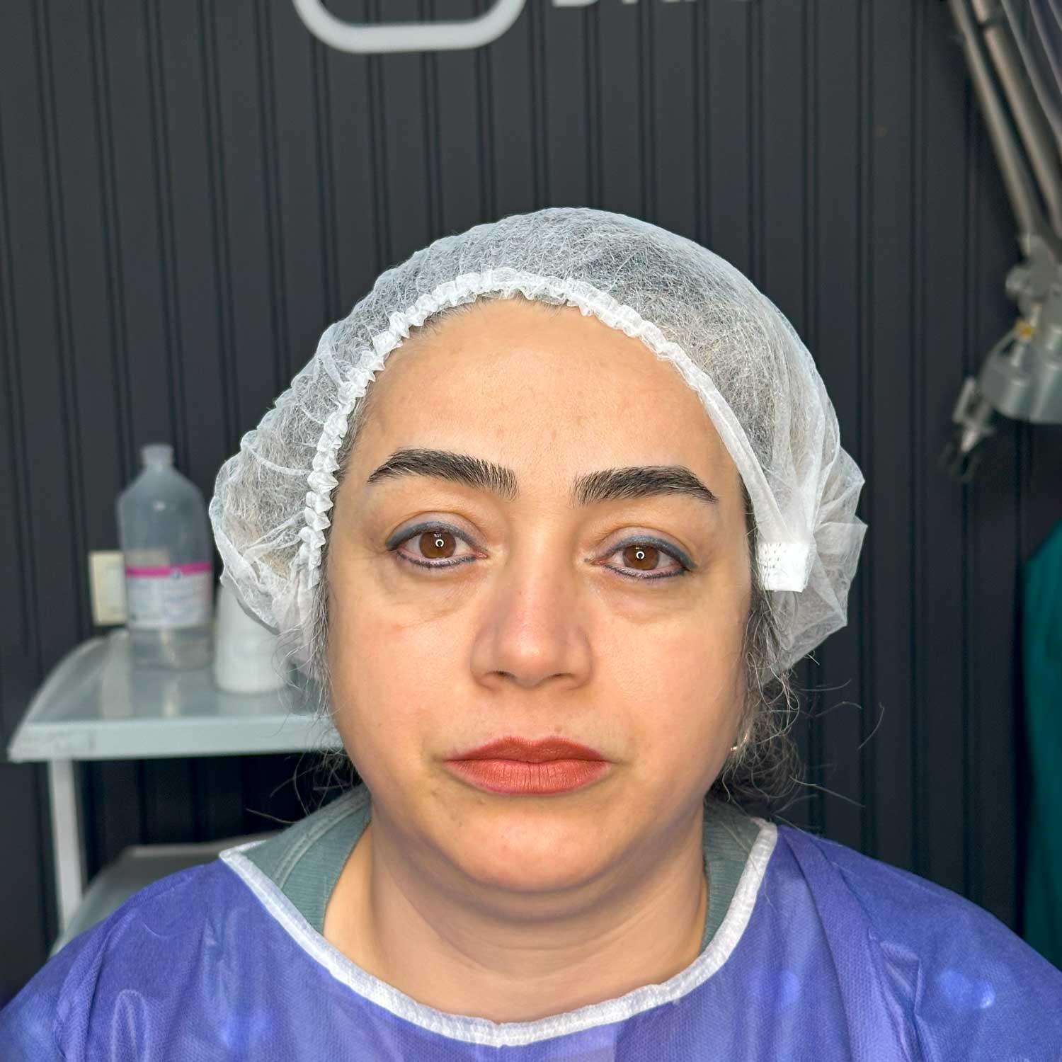 قبل - کیس ۱