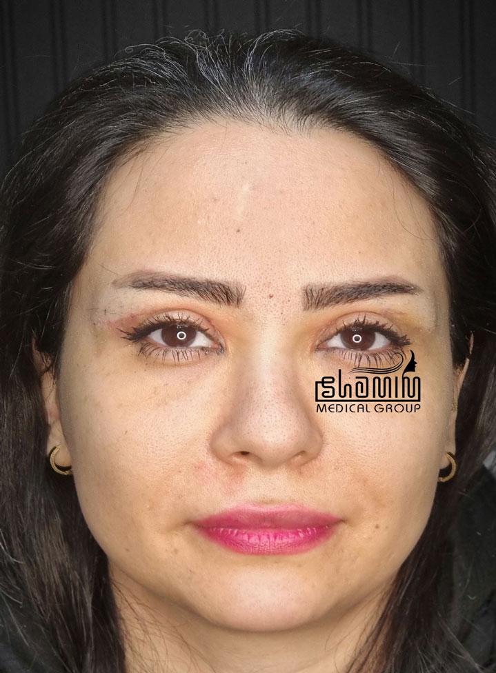 بعد - کیس ۳
