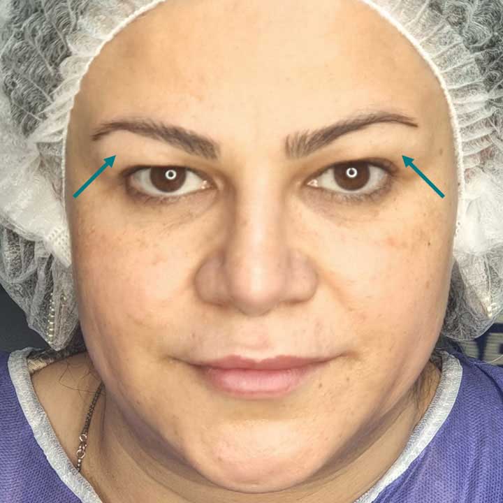 قبل - نمای کنارهم