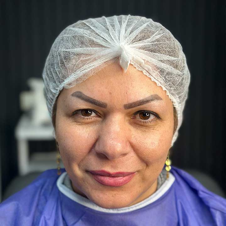 قبل - نمای کنارهم