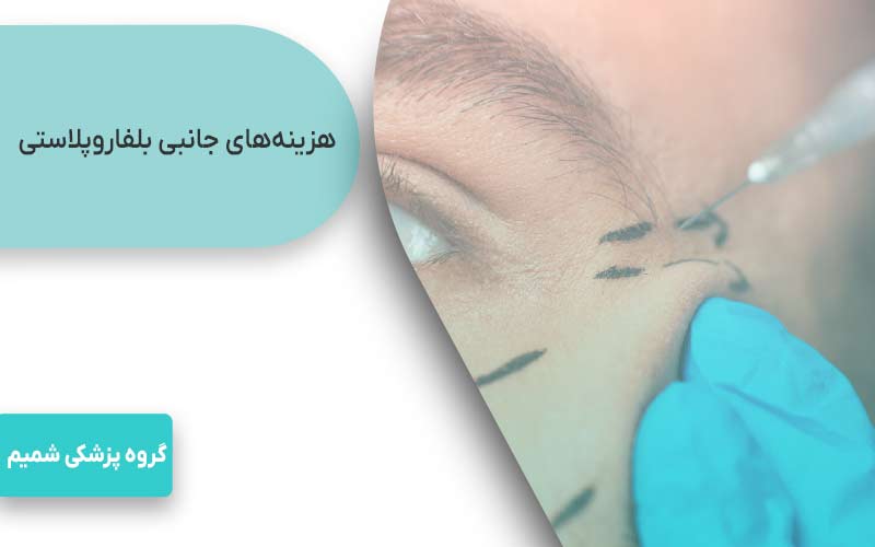 هزینه‌های جانبی بلفاروپلاستی