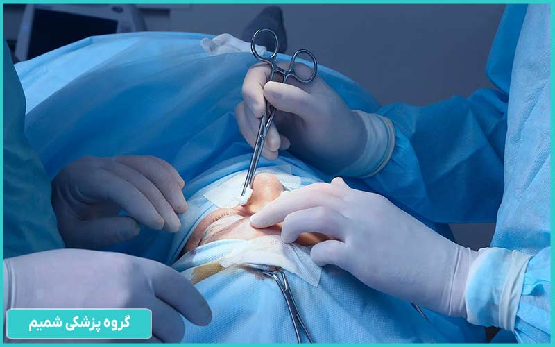 جراحی با برش پوستی در کرج