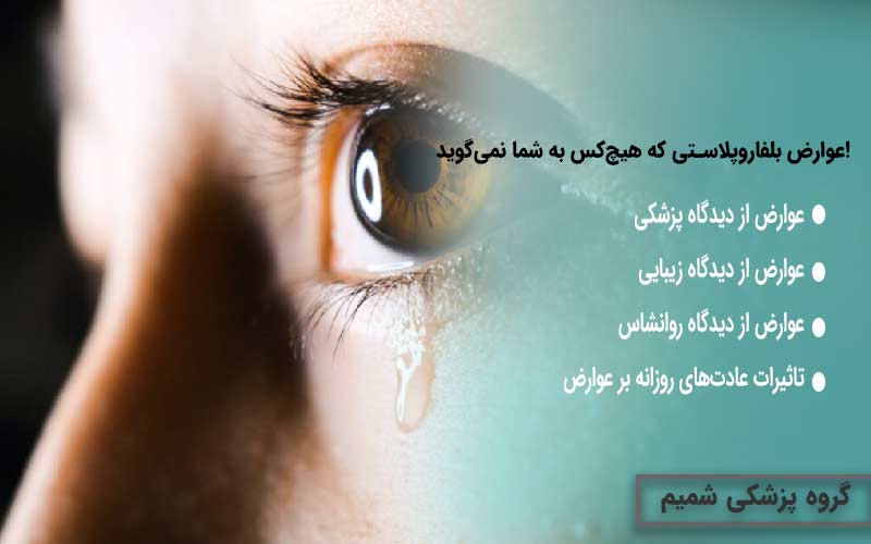 Complications of blepharoplasty