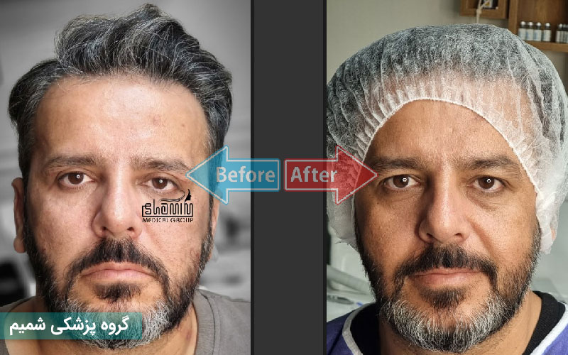 ملاک‌های انتخاب کلینیک معتبر بلفاروپلاستی در کرج