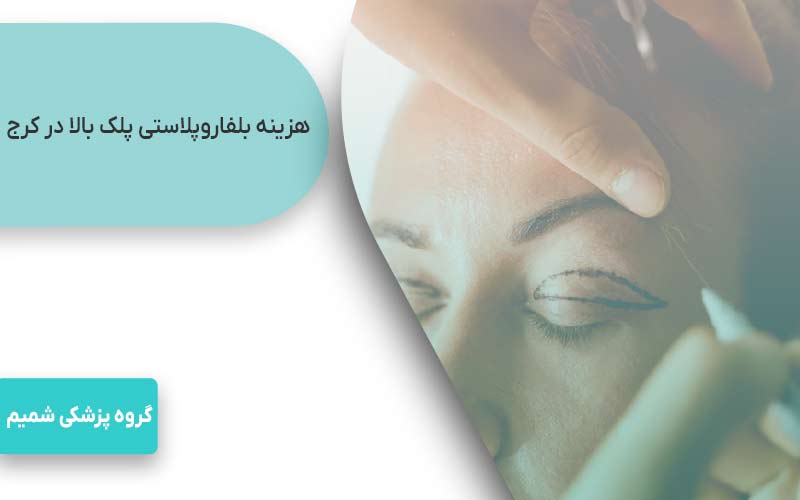 هزینه بلفاروپلاستی پلک بالا در کرج