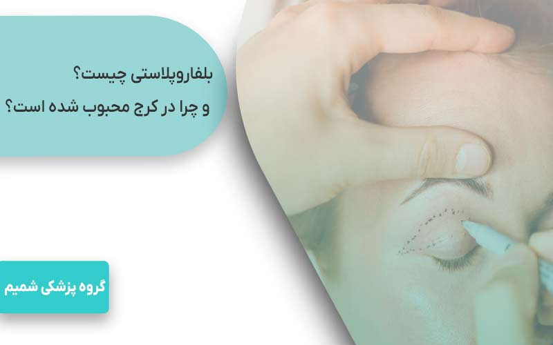بلفاروپلاستی چیست و چرا در کرج محبوب شده است؟