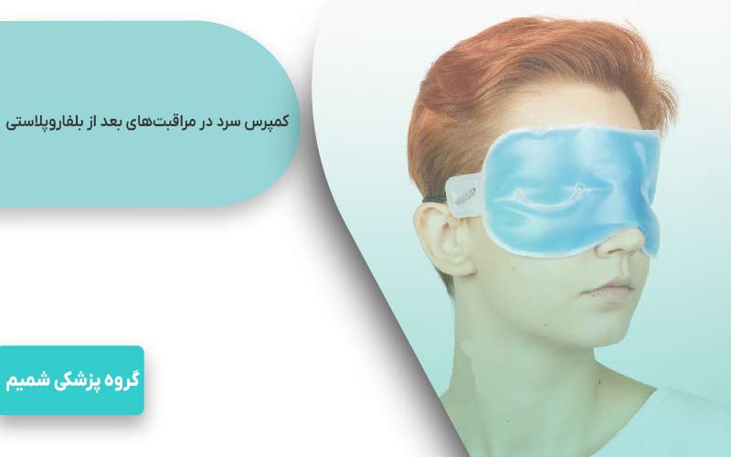 مراقبتهای بعد از بلفاروپلاستی 1 کمپرس سرد در مراقبتهای بعد از بلفاروپلاستی