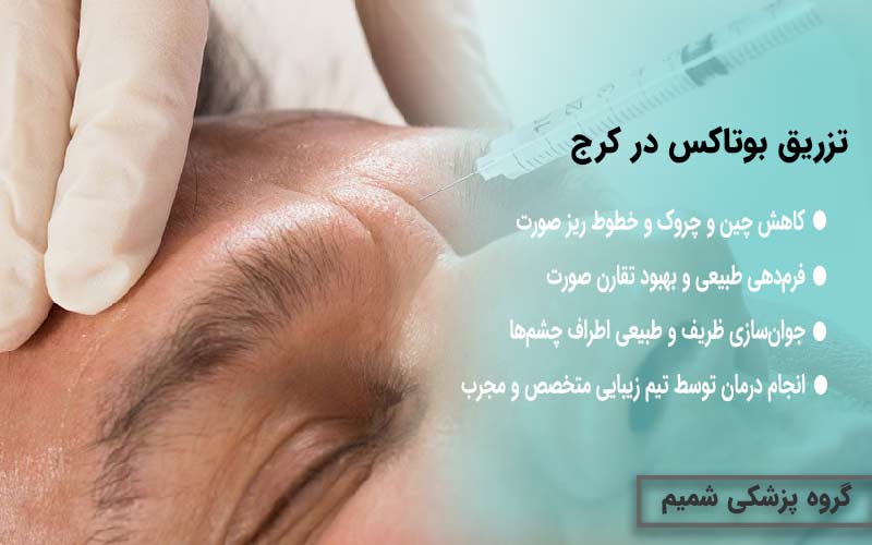 بوتاکس کرج