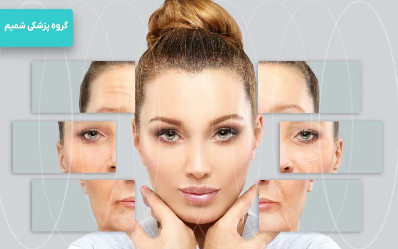 تفاوت بوتاکس در نواحی مختلف