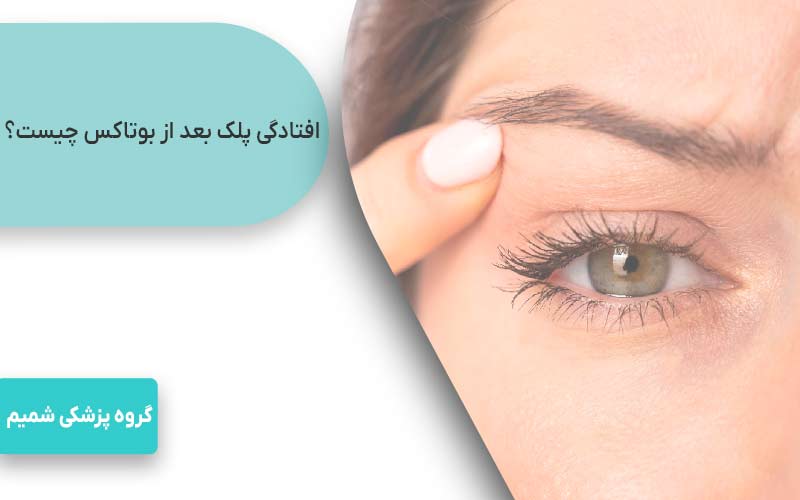 افتادگی پلک بعد از بوتاکس چیست؟