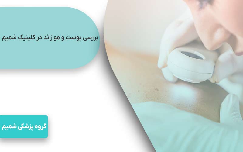 بررسی لیزر موهای زائد در کرج