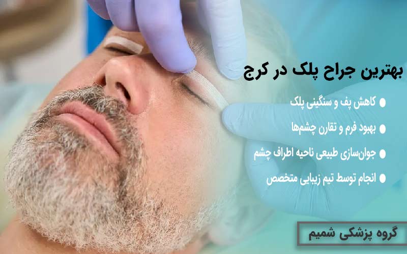 بهترین جراح پلک در کرج