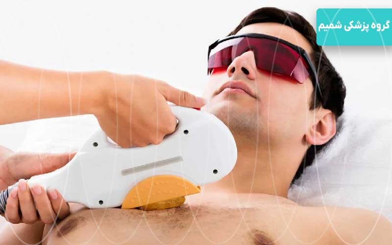 لیزر سینه و شکم برای اقایان 