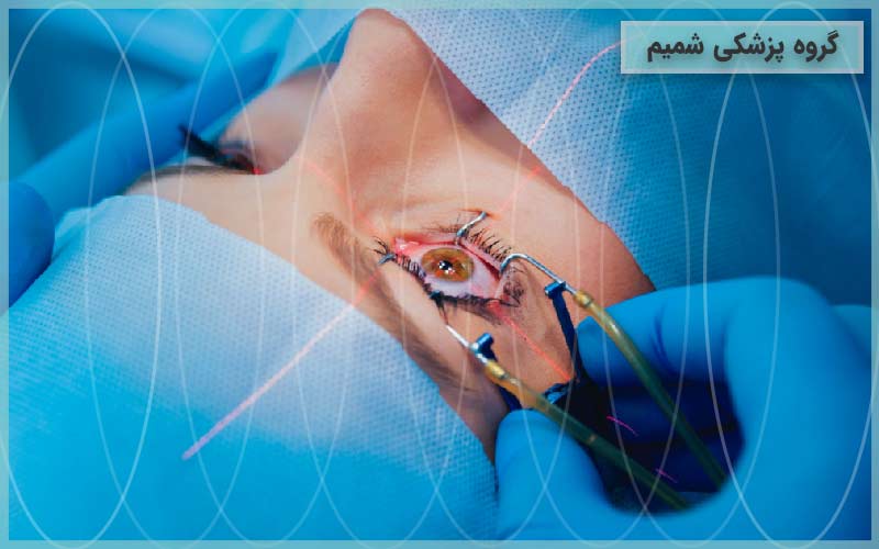 جراحی پلک در کرج