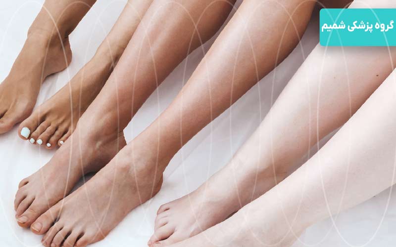 لیزر بازو و پاها در بانوان گوهردشت کرج 