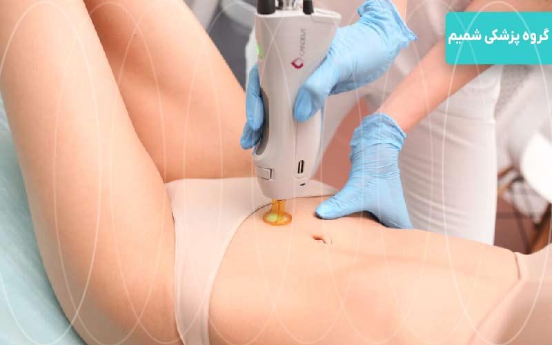 لیزرزیربغل و بیکینی برای بانوان گوهردشت کرج 