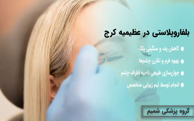 بلفاروپلاستی در عظیمیه کرج