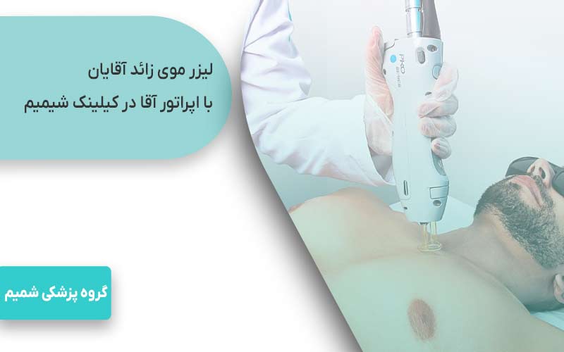  لیزر موی زائد آقایان با اپراتور آقا در کیلینک شمیم