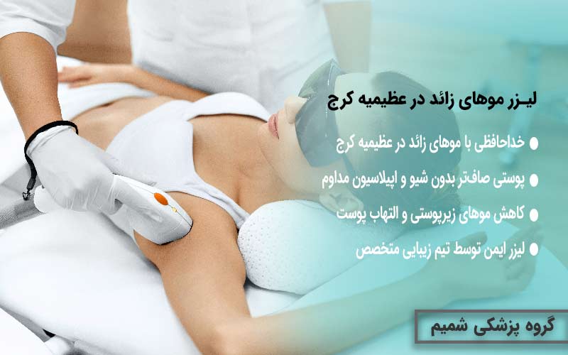 لیزر موهای زائد در عظیمیه کرج