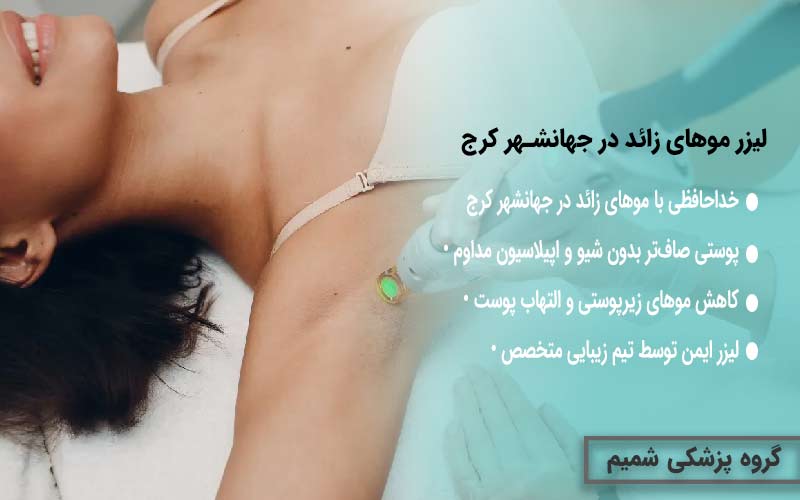 لیزر موهای زائد در جهانشهر کرج