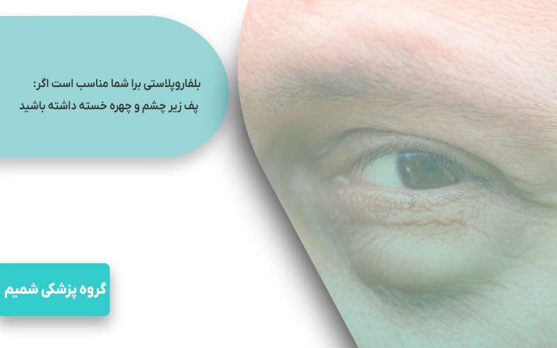 بلفاروپلاستی در عظیمیه کرج 2 پف زیر چشم و چهره خسته