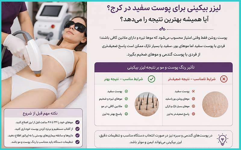 لیزر بیکینی در کرج 3 لیزر بیکینی برای پوست سفید در کرج