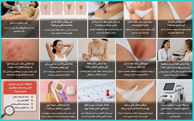 لیزر فول بادی در کرج 1 لیزر بیکینی در کرج