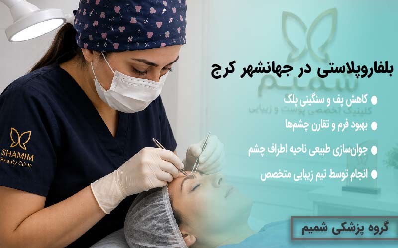بلفاروپلاستی در جهانشهر کرج