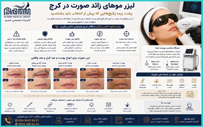 لیزر موهای زائد صورت در کرج