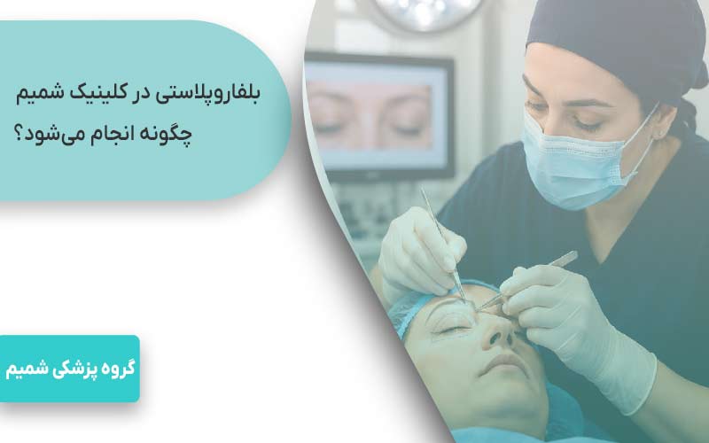 بلفاروپلاستی در جهانشهر کرج 2 بلفاروپلاستی در کلینیک شمیم چگونه انجام میشود؟