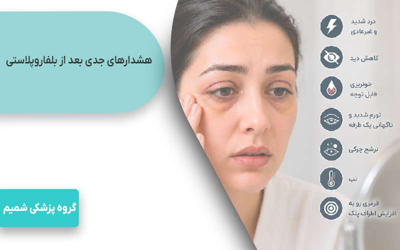 بلفاروپلاستی در جهانشهر کرج 6 هشدارهای جدی بعد از بلفاروپلاستی