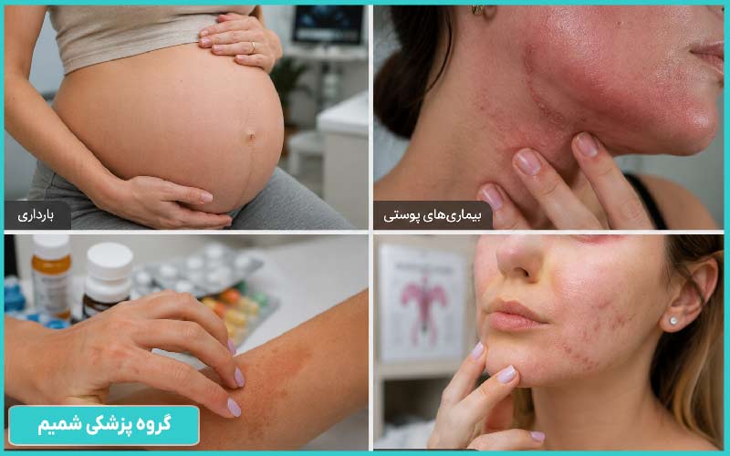 بارداری، بیماری‌های پوستی، داروهای حساس‌کننده به نور و مشکلات هورمونی