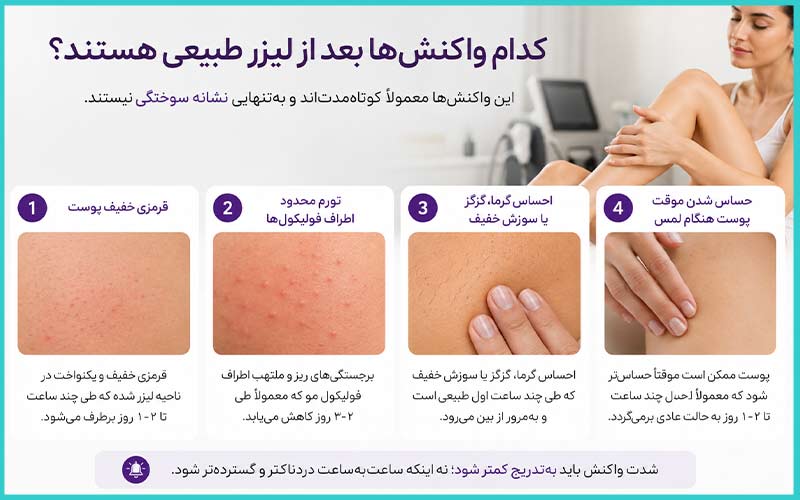 لیزر فول بادی در کرج 3 کدام واکنشها بعد از لیزر طبیعی هستند؟