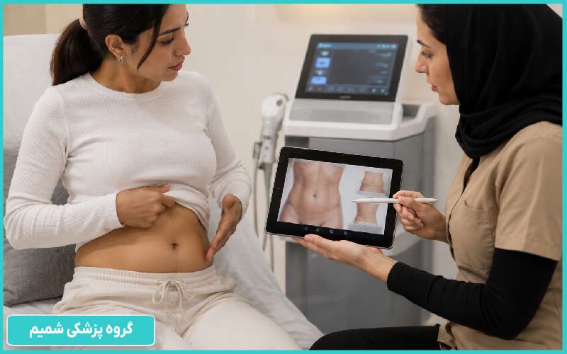 هایفو شکم در کرج|لیفت شکم بدون جراحی، با هزینهای منطقیتر 2 چه کسانی کاندید مناسب هایفو شکم در کرج هستند
