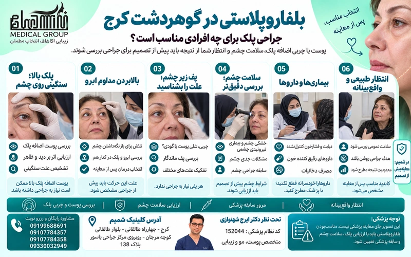 بلفاروپلاستی در گوهردشت کرج برای چه افرادی مناسب است؟
