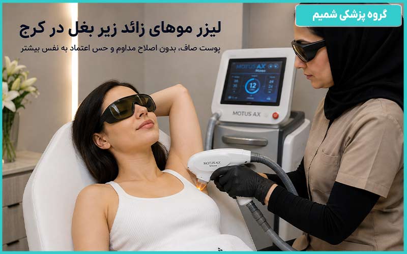 لیزر زیر بغل در کرج