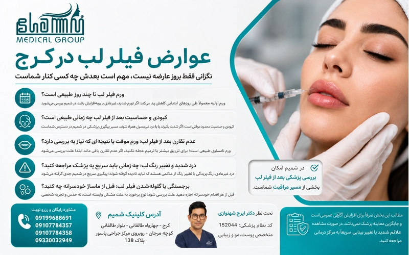 عوارض فیلر لب در کرج
