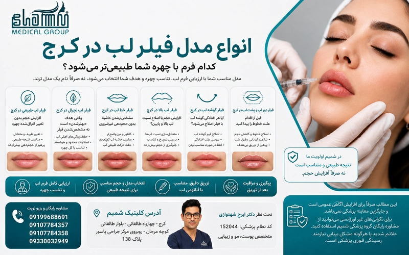 انواع مدل فیلر لب در کرج