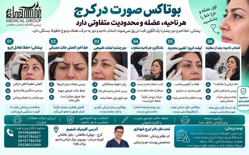 بوتاکس صورت برای کدام نواحی مناسب است؟