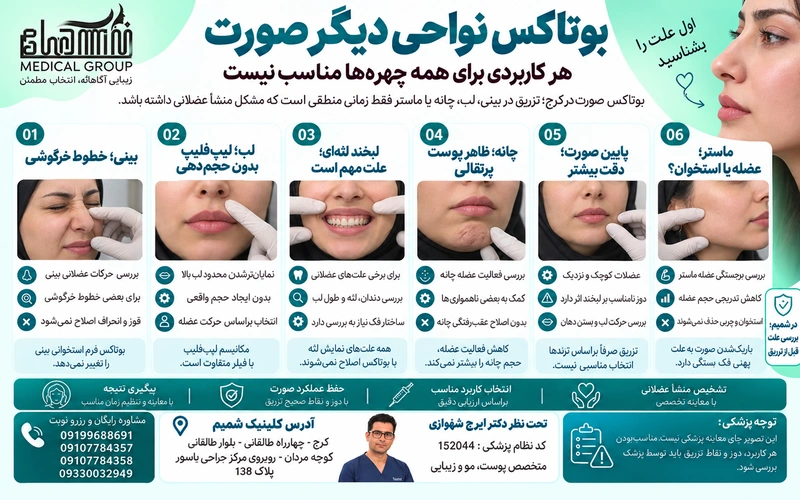 بوتاکس نواحی دیگر صورت