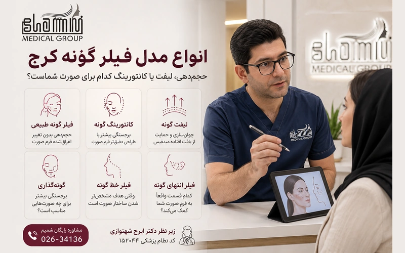 انواع مدل فیلر گونه کرج