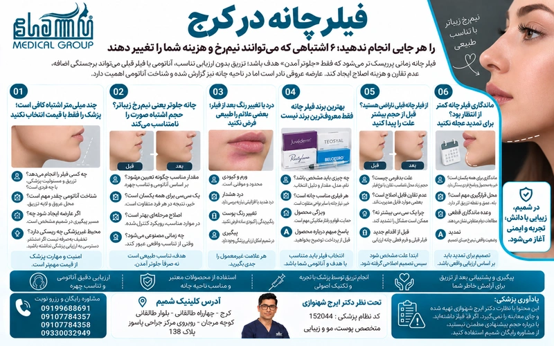 فیلر چانه کرج