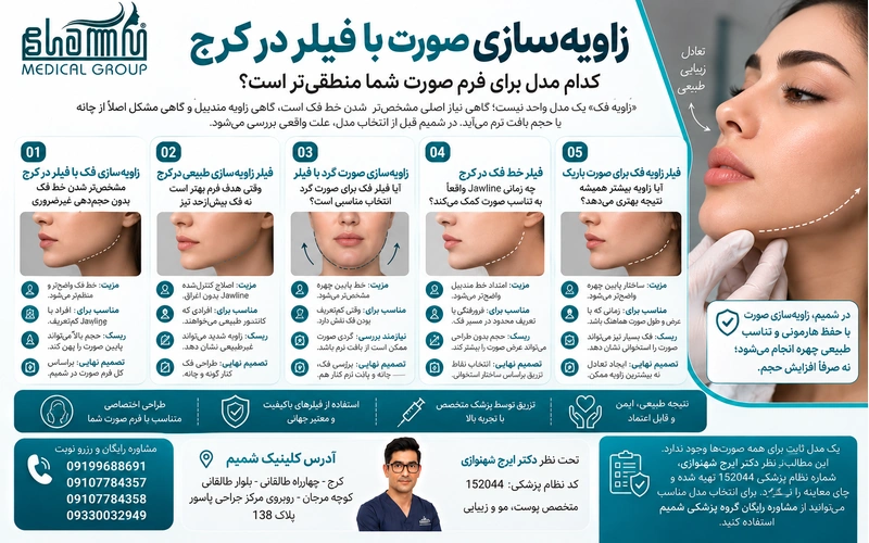 فیلر زاویه فک کرج 3 زاویهسازی صورت با فیلر کرج