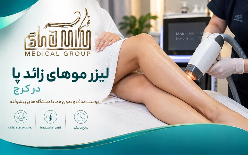 لیزر موهای زائد پا در کرج