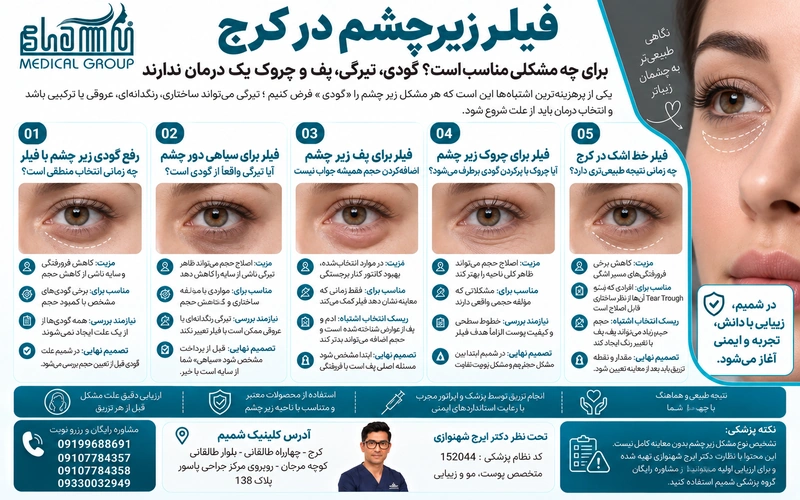 تزریق فیلر زیر چشم در کرج 2 فیلر زیر چشم برای چه مشکلی مناسب است؟