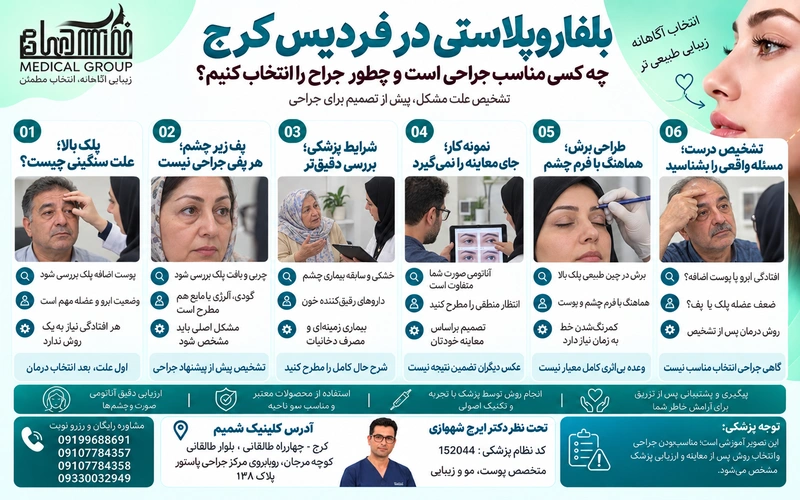 بلفاروپلاستی در فردیس کرج 1 بلفاروپلاستی در فردیس کرج برای چه افرادی مناسب است؟